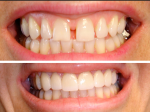 Cosmetic Dentist Fairhope