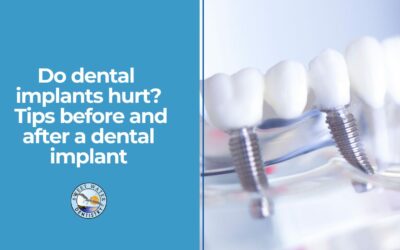Do Dental Implants Hurt? Tips Before and After a Dental Implant