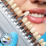 teeth whitening