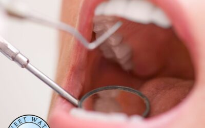 How Can I Address Bad Breath (halitosis)?