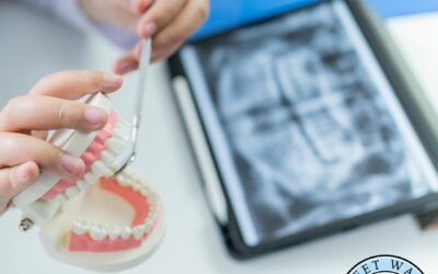 Are You Without Teeth During The Implant Process?