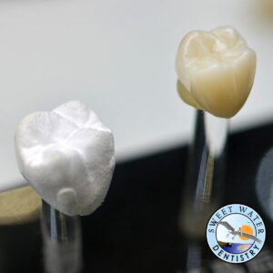 What Materials Are Dental Crowns Made From