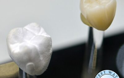 What Materials Are Dental Crowns Made From? A Comprehensive Guide