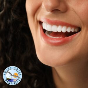 Porcelain Veneers in Fairhope, AL