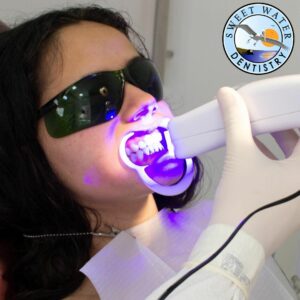 whitening
