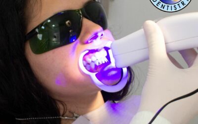 Fairhope Dentist AL KoR Whitening