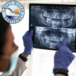 Which Location In The Mouth Has The Highest Failure Rate For Dental Implant
