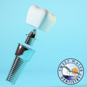 Tooth implant