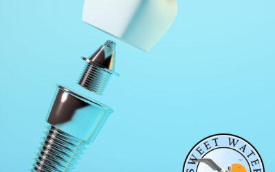 How Long Should Pain Last After A Tooth Implant?