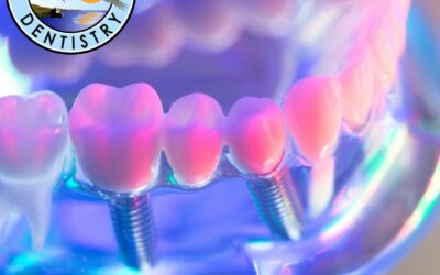How Long Does It Take to Get Dental Implants? A Complete Guide