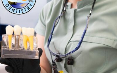 How Long Do Implants Need To Settle?