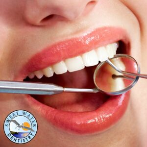 Dental Implant