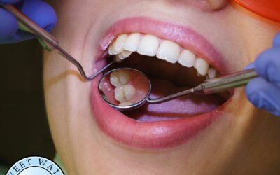Do You Need Anaesthetic For A Dental Implant?