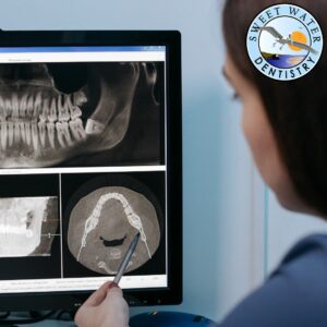 Bone Graft Before Getting Dental Implants