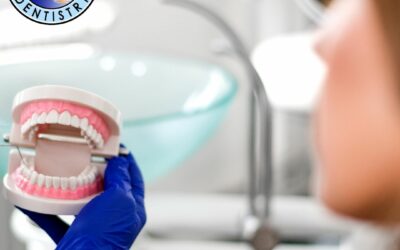 How Is a Dental Crown Placed? A Step-by-Step Guide