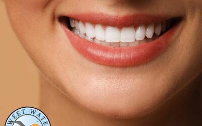 Are Teeth Whitening Treatments Safe, and How Long Do They Last?