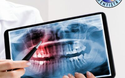 What Are the Signs of an Infected Tooth? A Complete Guide to Symptoms and Treatment