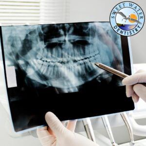 x-ray