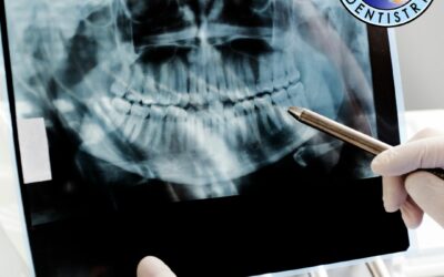 Are X-rays Safe, And How Often Do I Need Them?
